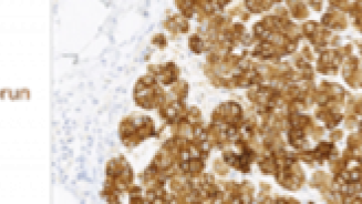 anapath-immunohistochimie