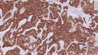 Immunohistochimie 