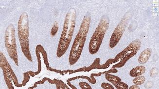Immunohistochimie 