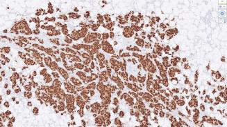 Immunohistochimie 